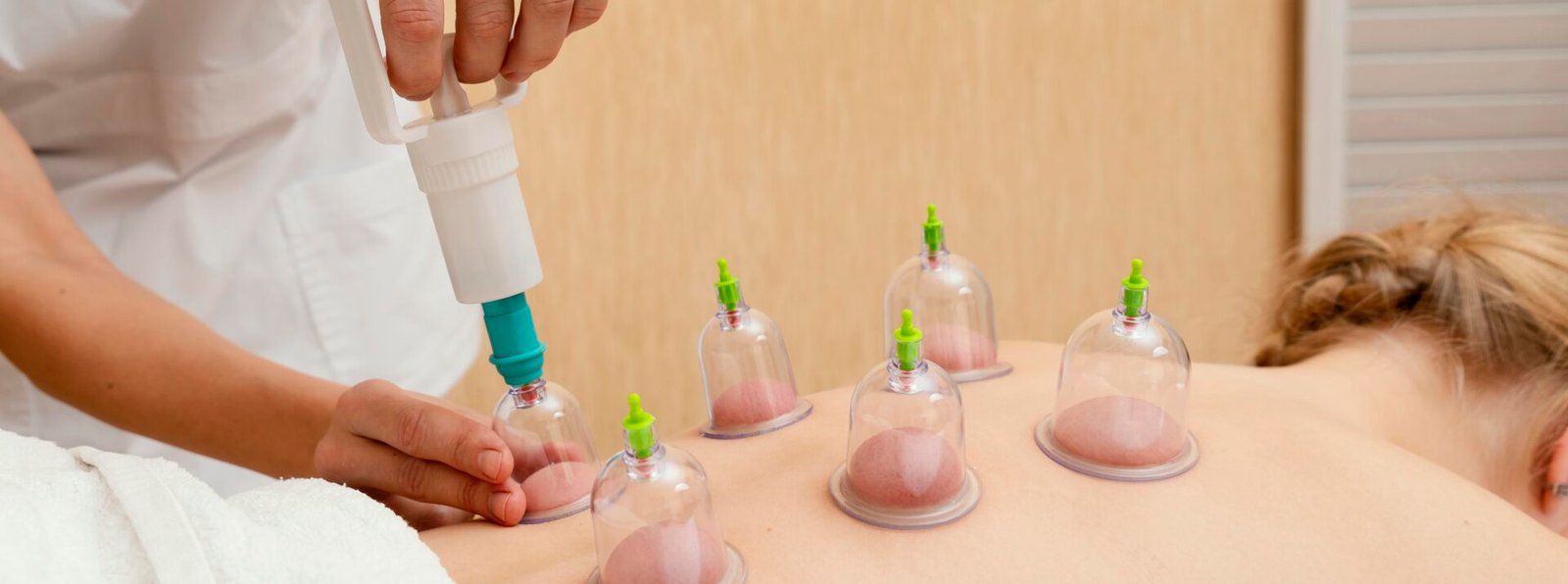 Revitalize your body with cupping therapy