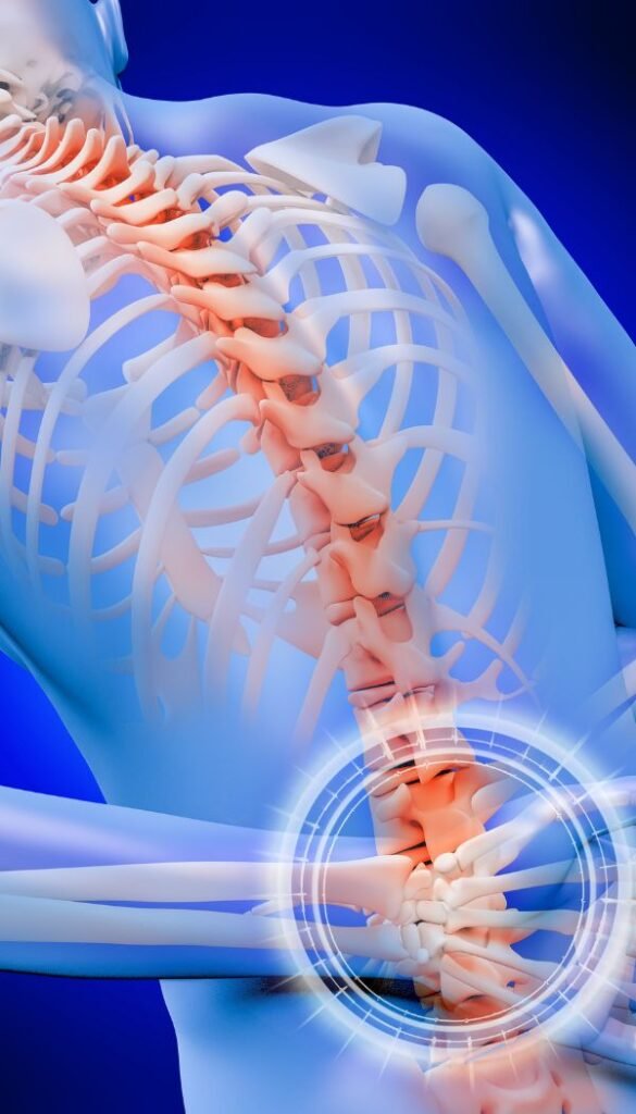 Lower Back Pain