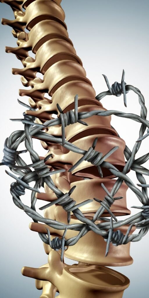 Mechanical Lower Back Pain