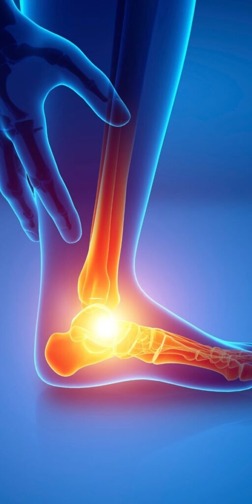 Plantar Fasciitis