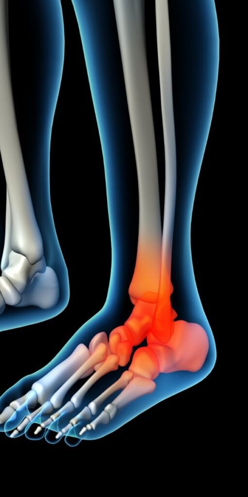 Tendinopathy